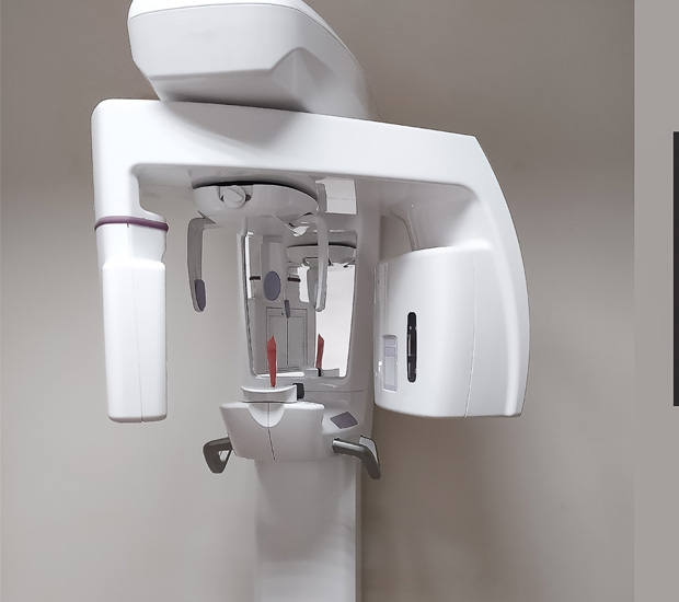 Houston 3D Cone Beam and 3D Dental Scans
