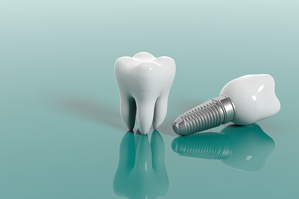 Cosmetic Dental Services Options With Implants from Midtown Dental - The Gallery of Smiles in Houston, TX