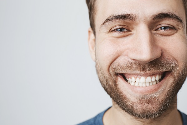 What Are Dental Bridges?