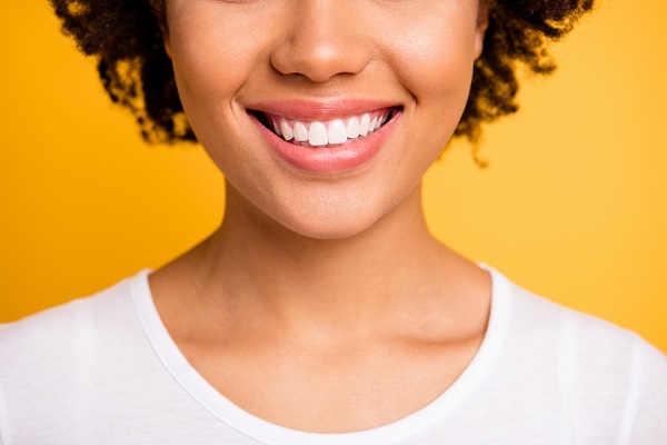 When Would A General Dentist Recommend Dental Veneers?