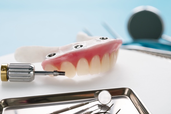 Bring Back A Stronger Smile With Implant Supported Dentures