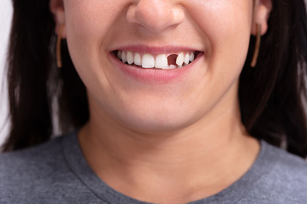 Options for Replacing Missing Teeth With Cosmetic Dental Services from Midtown Dental - The Gallery of Smiles in Houston, TX