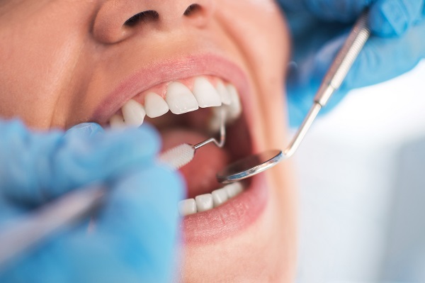 A General Dentist Discusses Oral Cancer Screenings