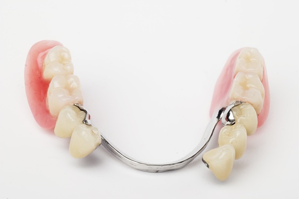 Partial Dentures: A Functional And Aesthetic Solution For Missing Teeth