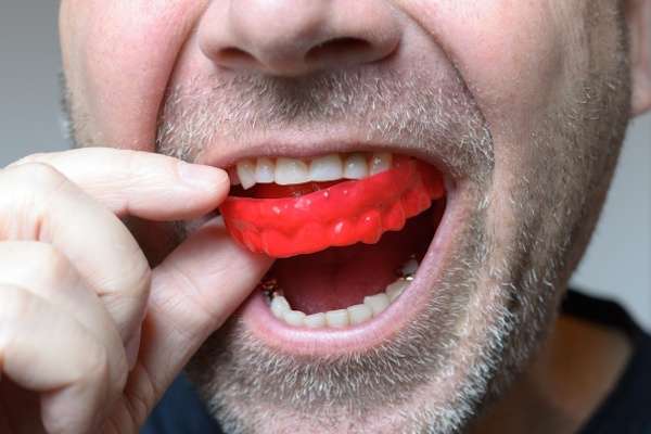 Save Your Teeth by Wearing Mouth Guards at Night from Midtown Dental - The Gallery of Smiles in Houston, TX